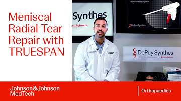 All-Inside Radial Meniscal Tear Repair with TRUESPAN Meniscal Repair System | DePuy Synthes