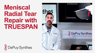 All-Inside Radial Meniscal Tear Repair with TRUESPAN Meniscal Repair ...