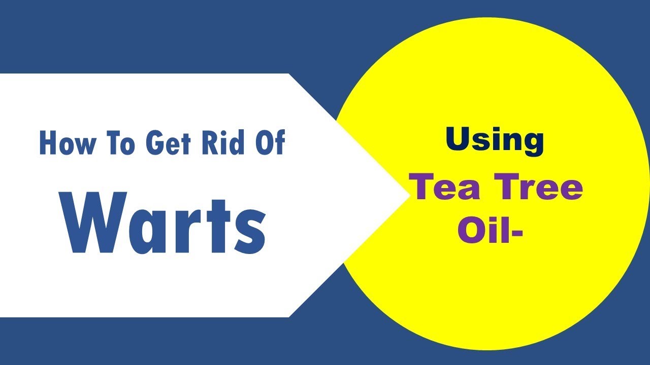 how to get rid of warts using Tea Tree Oil YouTube