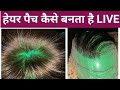 देखिये हेयर पैच कैसे बनते है || Latest Hair FIxing & Hair Patch|| Wig Making Process Step by Step ||