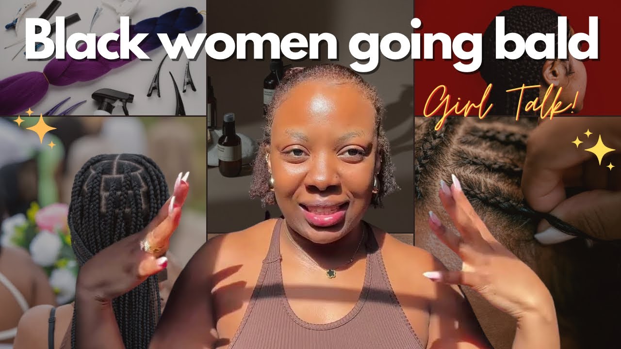 Почему так много чернокожих женщин лысеют? Выпадение волос, алопеция и вредные косы