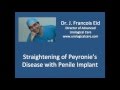 Straightening of Peyronie's Disease with Penile Implant