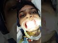 😲 “Itna plaque nikla! Aakhri tak dekhiye 😍”#ViralVideo #TrendingNow #dentist