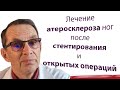 Лечение атеросклероза ног после операций. Видеобеседа для ВСЕХ