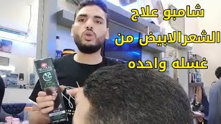 افضل طريقه للتخلص من الشيب نهائيا وداعا للشعر الابيض