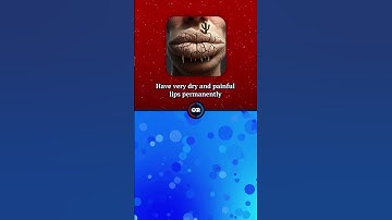 Neither is the best option (Would you rather)🫣 #wouldyourather #quiz #game #fyp #challenge