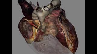 3D Heart Anatomy
