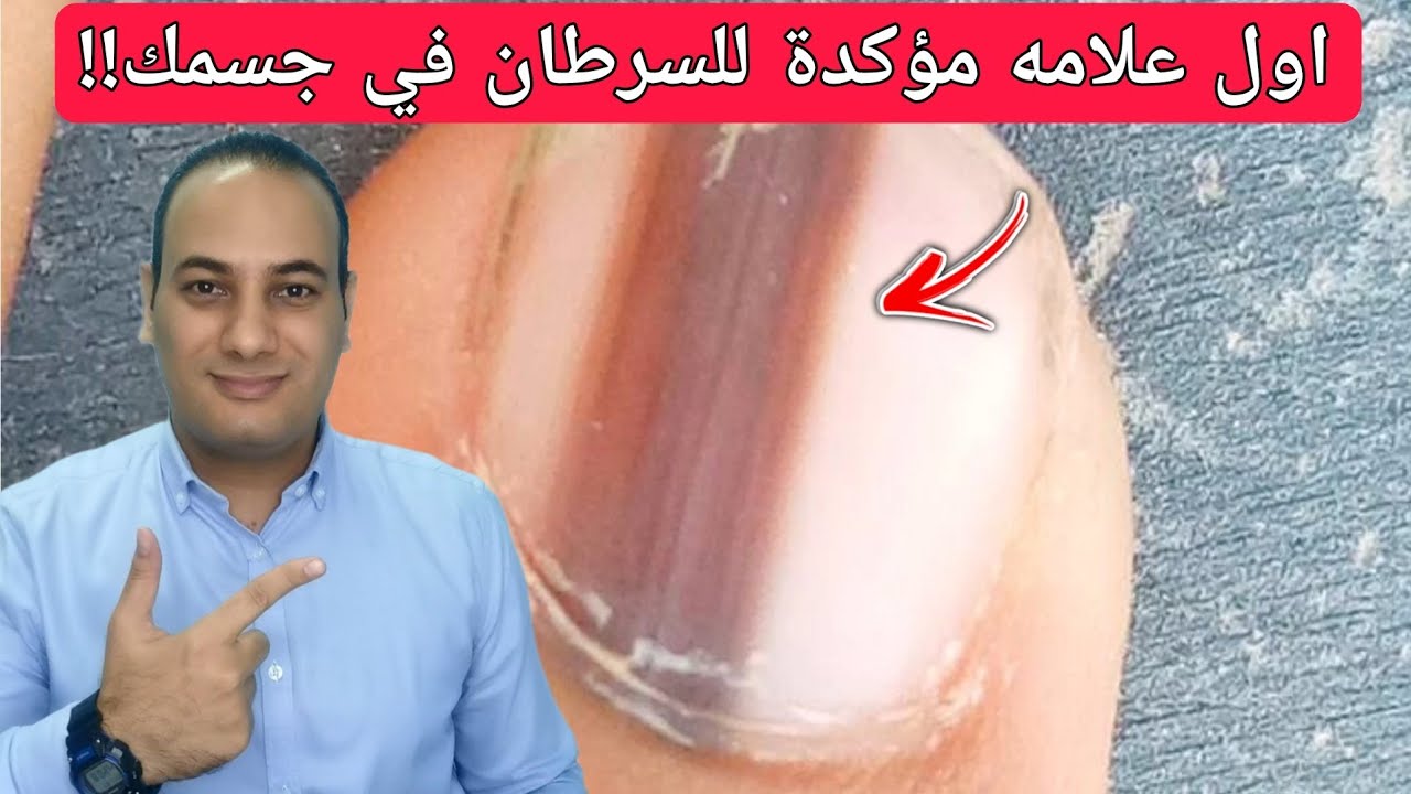 8 علامات مؤكده للسرطان ينمو في جسمك وانت لا تعلم/ما هي اعراض السرطان المبكرة!!