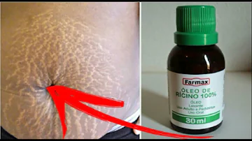 Como usar o óleo de rícino nas estrias?