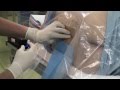 今週の硬膜外麻酔5例 2 epidural anesthesia by Dr.EpiCal