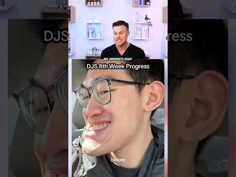 Dentist Reacts To DOUBLE JAW Surgery! 😳🦷