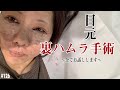 【手術】目元のたるみ、ちりめんじわ、クマを消し去る手術 【全てお話しします】裏ハムラ まずは手術当日まで Ver.126 ♥