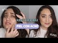 COMO ELIMINAR el ACNÉ RÁPIDAMENTE!! con MAQUILLAJE😨| Andreaalvarezmp