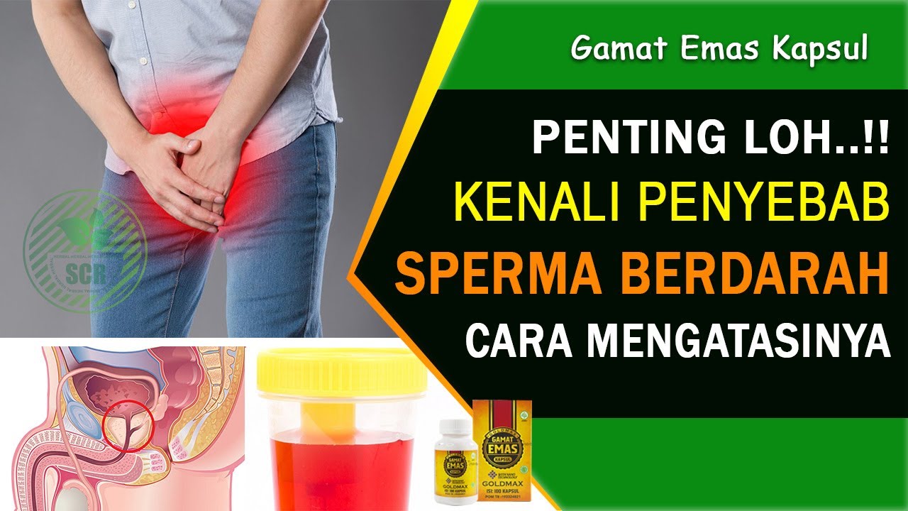 Kenali Penyebab dan Cara Mengatasi Sperma Berdarah - Gamat Emas Kapsul