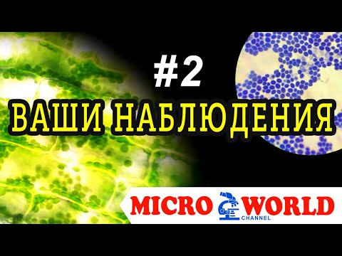 ВАШИ НАБЛЮДЕНИЯ #2