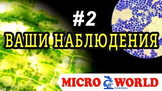 ВАШИ НАБЛЮДЕНИЯ #2 - MICRO WORLD