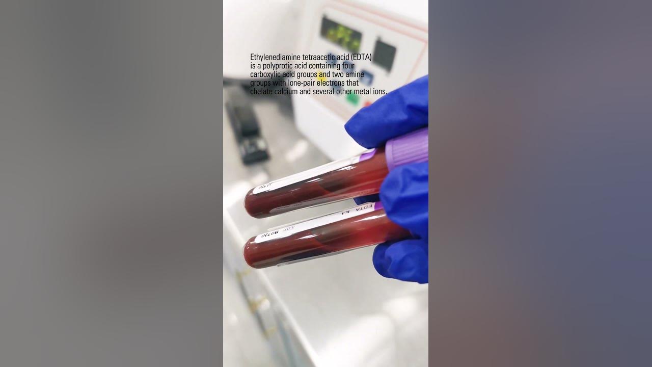 preparing-plasma-from-edta-lavender-top-tube-laboratory-cls-mls