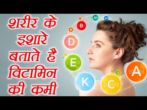 Body signs indicate Vitamin deficiencies | शरीर के संकेत बताते हैं विटामिन की कमी | Boldsky