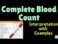 Complete Blood Count (CBC) with Differentials: Interpretation with Examples | Full Blood Count (FBC)