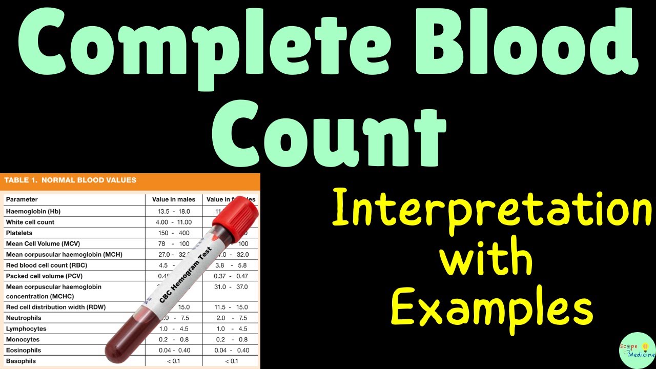 Complete Blood Count (CBC) with Differentials: Interpretation with ...