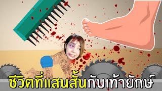 ชีวิตที่แสนสั้นกับเท้ายักษ์