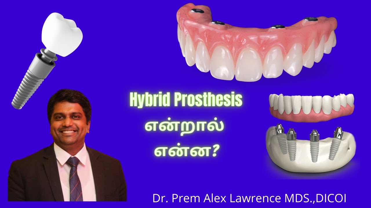 Hybrid Prosthesis என்றால் என்ன? What is hybrid prosthesis what is a