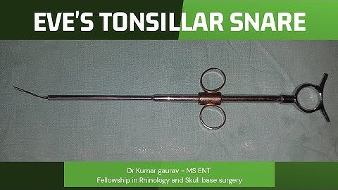 EVE, TONSILLAR SNARE