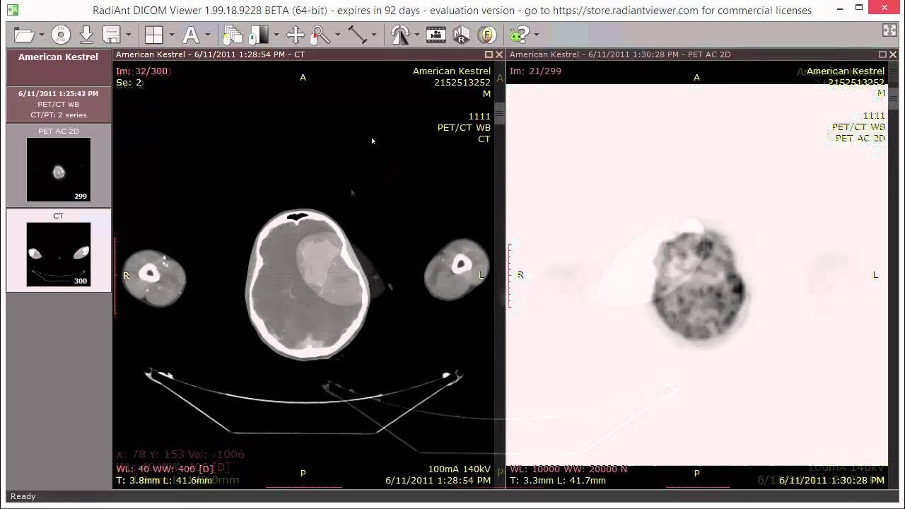 Radiant dicom viewer. Dicom снимки. Мрт в формате dicom что это такое. Radiant dicom viewer. Радиант кт.