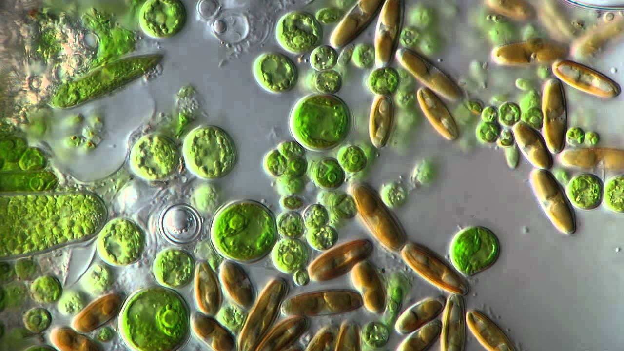 Микроорганизмы питьевой воды. Микроводоросли микробиология. Ооцистис водоросль микроскоп. Микроскопические зеленые водоросли. Микроводоросли и бактерии.