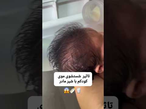 امتحان کن نتیجه عالیه نوزاد  نینی