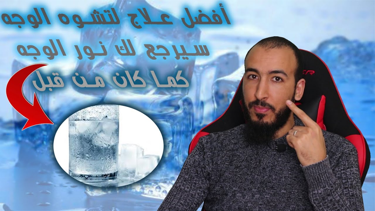 وصفة سهلة جدا لعلاج تشوه الوجه والجمال بسبب السحر والمس والعين والحسد وفك عقد الوجه وإرجاع الجمال