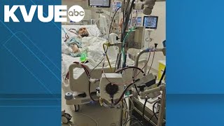 Houston doctors perform first fully robotic heart transplant in US