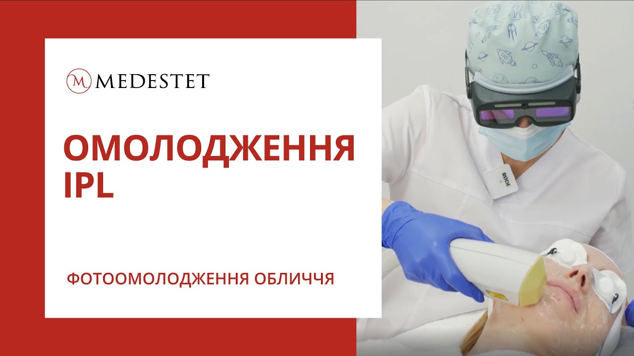 Процедура IPL терапия фотоомоложение лица на аппарате Exilite. Лечение пигментации. МедЭстет Винница