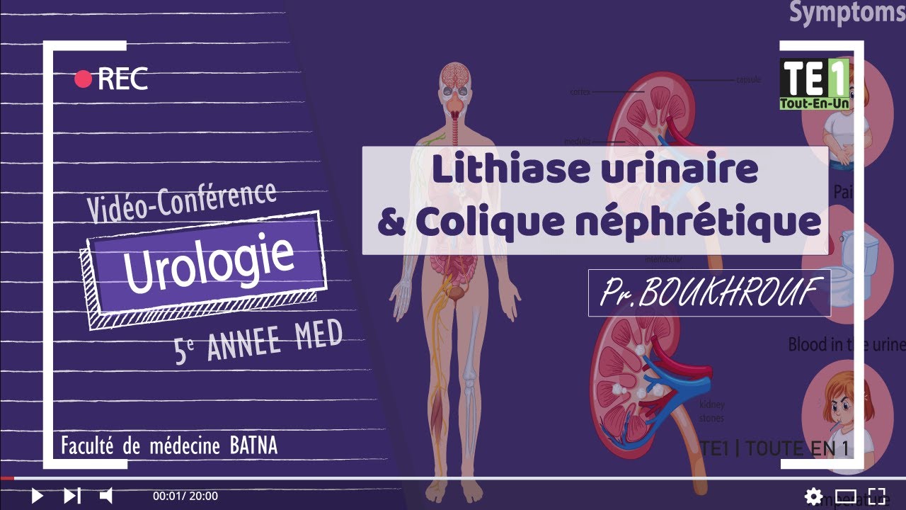Lithiase urinaire &  Colique néphrétique