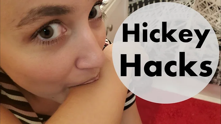Hickey Hacks: How to get rid of a hickey AKA a lov...