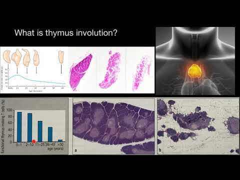 What is thymus INVOLUTION?