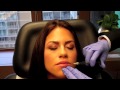 Juvederm Lip Injection Dr Naderi Maryland Virginia Washington DC