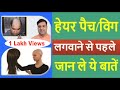 हेयर पैच/विग लगवाने से पहले जान ले ये बातें | Know these things before Wearing Hair Patch / Wig