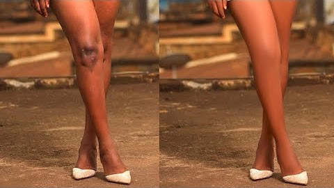 Fix Dark Knees and Knuckles In Photoshop
