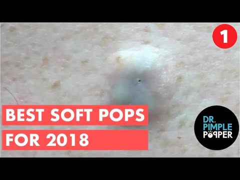 The BEST OF Softpops 2015 for Part Dr Pimple -