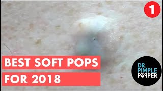 The BEST OF Softpops 2015 for 2018 Part 1! Dr Pimple Popper