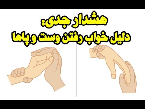 تصویری: آیا برای بی حسی باید به پزشک مراجعه کرد؟