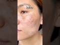 Shocking Results: From Dark Spots to Glowing Skin!✨ #skinrepair #naturalbeauty #foryou