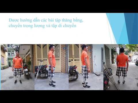 Hai chân giả trên gối Bi-Lateral transfemorl amputatee with his two prostheses