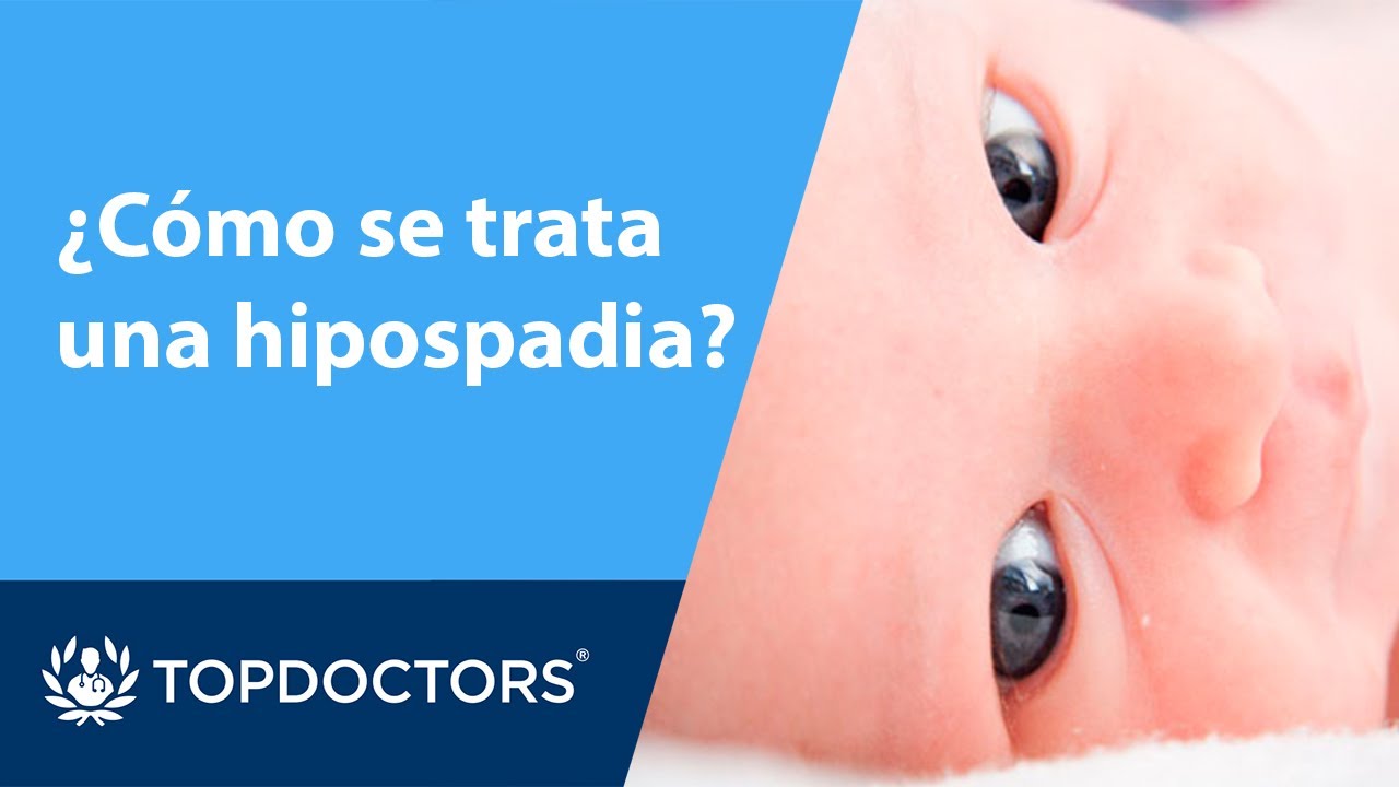 ¿Cómo se trata una hipospadia? (2/4) - Dr. Cabezalí - YouTube