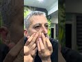 Skincare satisfying videos #pimples #pimplepopping #acne #remove #hairremoval #trendine #blackheads