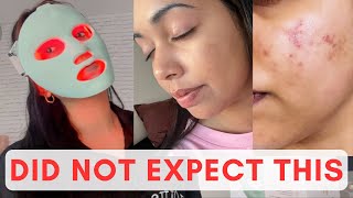 Non Sponsored LED mask review - before and after!  - QURE infrared light therapy ✨