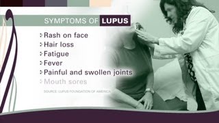 Life with lupus: One woman's story