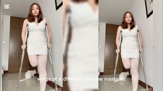 She Lost Everything But Her Spirit: A Journey on One Leg#amputee 