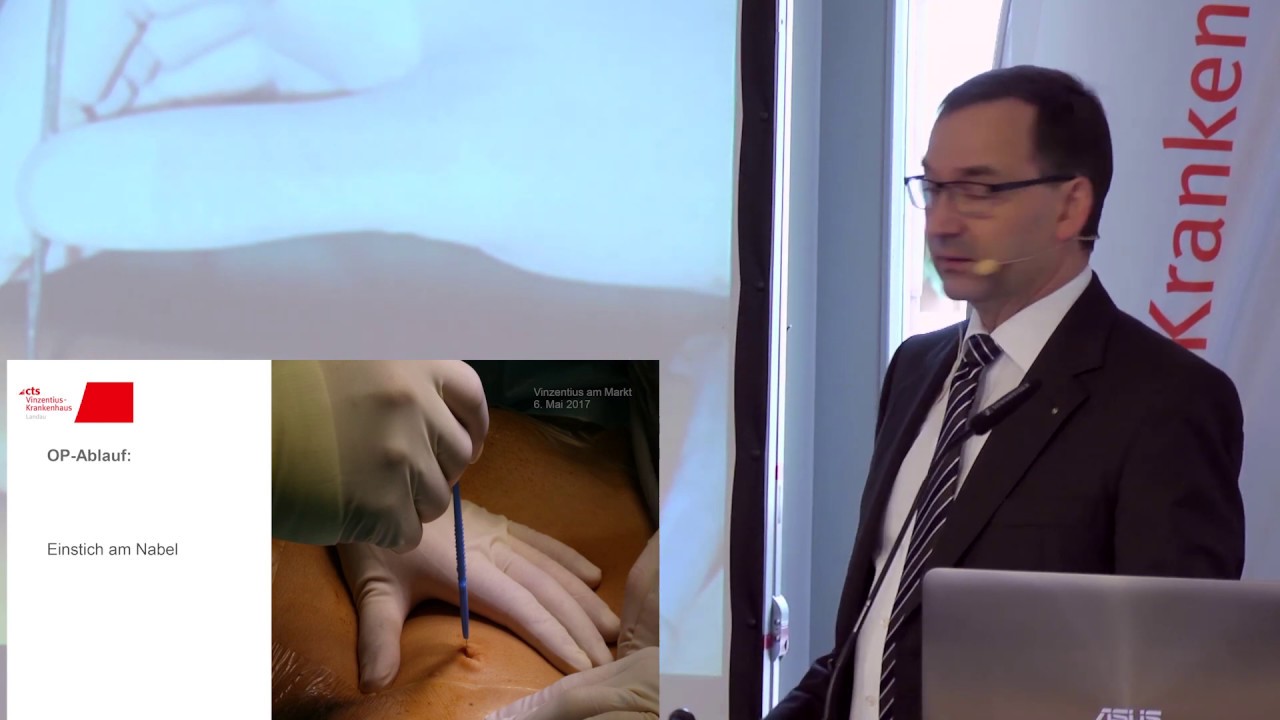 Leistenbruch operiert mit der laparoskopischen Technik (E4) | SOS Großstadtklinik